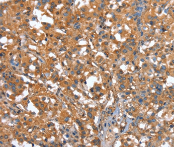 CAPZA1 Antibody