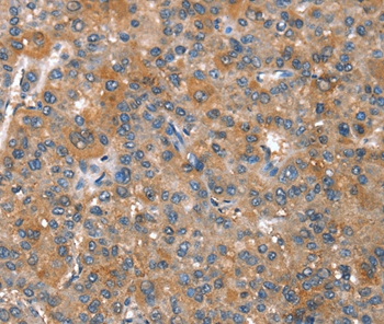 CAPZA1 Antibody