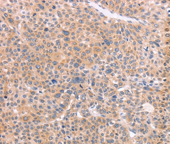 NCAM1 Antibody