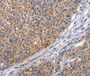 CD5L Antibody