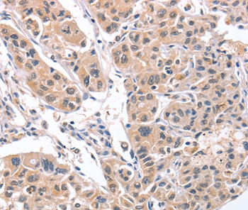 CD5L Antibody