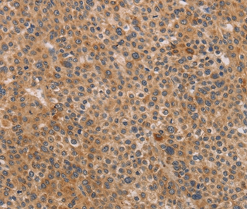 CDK11A/CDK11B Antibody