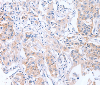 CDCA4 Antibody