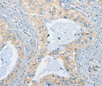 CHRNA2 Antibody