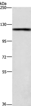 TSPYL2 Antibody