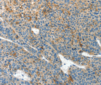 CLPTM1L Antibody