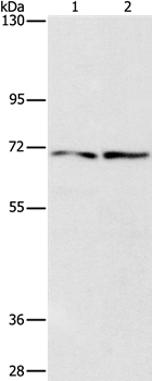 IFT74 Antibody