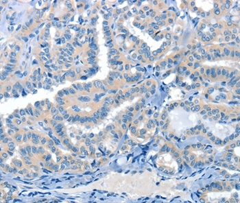 CRLF2 Antibody