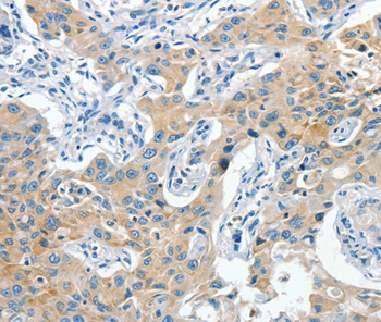 CNTNAP3 Antibody