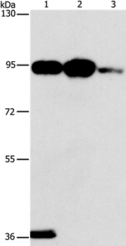 PLA2G4B Antibody