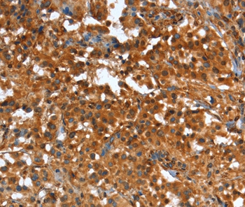 CR1 Antibody