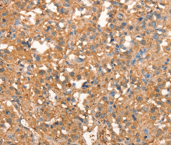 CRELD1 Antibody