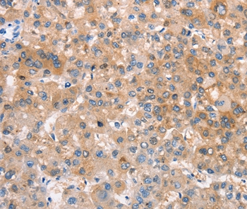 CRHR2 Antibody