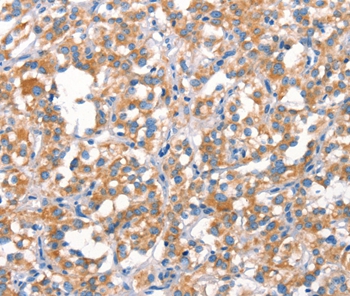 MT-CYB Antibody