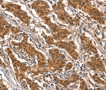 CYP2B6 Antibody