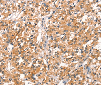 RHOBTB2 Antibody