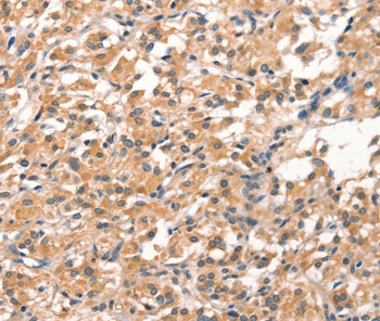 DEAF1 Antibody