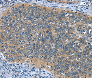 DTX1 Antibody