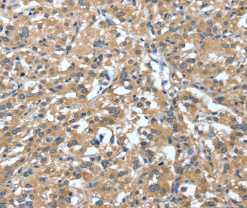 DTX1 Antibody