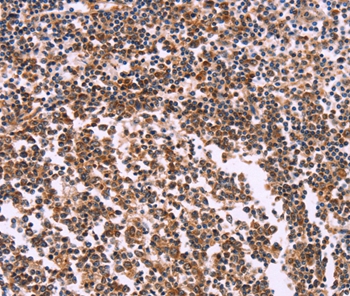 MSMO1 Antibody