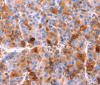 ERN2 Antibody