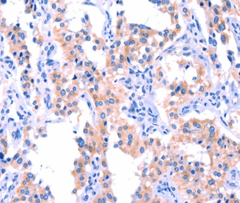 ERN2 Antibody