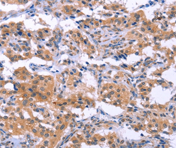 ESPL1 Antibody