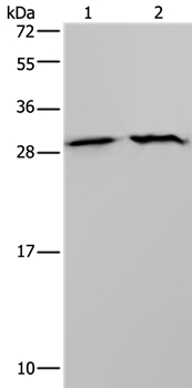 ETFB Antibody