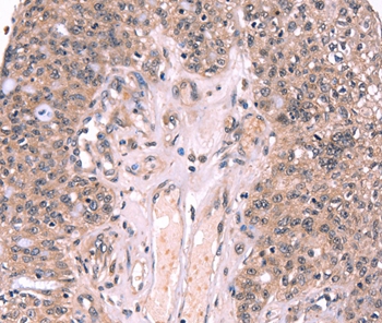 EXTL1 Antibody