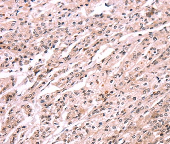 EXTL1 Antibody