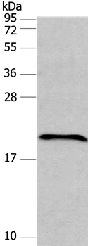 FAIM Antibody