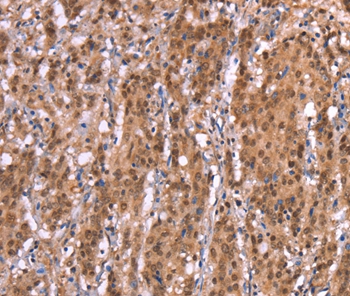 AMER1 Antibody