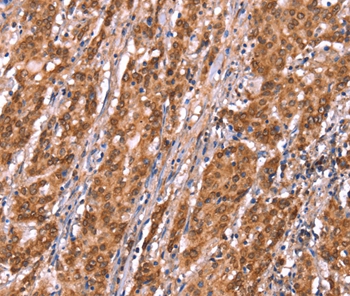 FAM13B Antibody