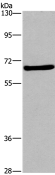 FEM1B Antibody