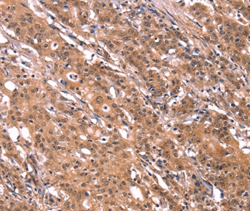 FGF22 Antibody