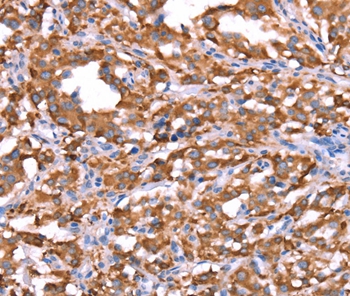 FXR1 Antibody