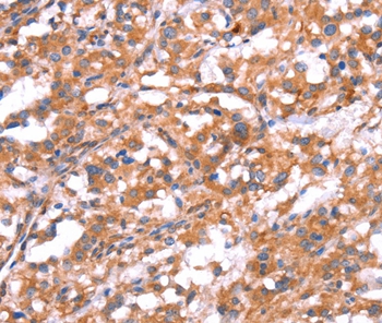 GABBR1 Antibody