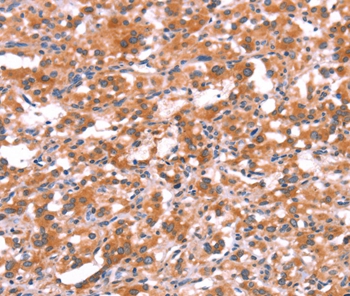 GABRG2 Antibody