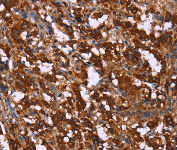 GAGE7 Antibody