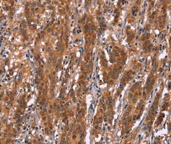 GPHN Antibody