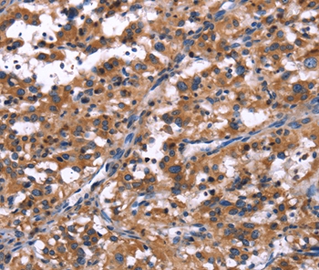 R3HCC1L Antibody