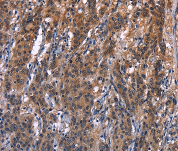 R3HCC1L Antibody