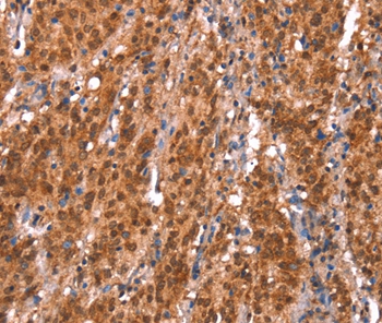 KCNJ6 Antibody