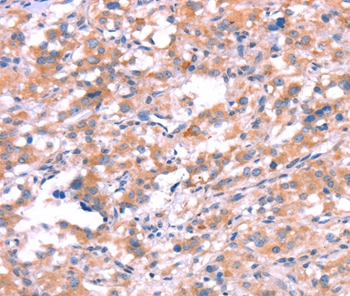 KCNJ6 Antibody