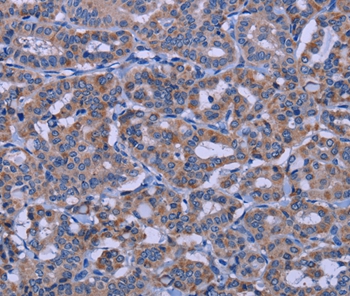 KCNJ9 Antibody