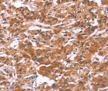 GLMN Antibody