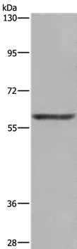 GLS Antibody