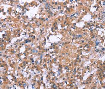 SLC52A1 Antibody