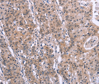 SLC52A1 Antibody