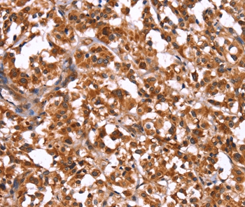 GUK1 Antibody